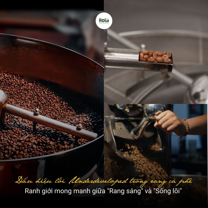 dau-hieu-loi-underdeveloped-trong-rang-ca-phe